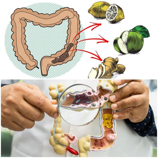 9 domowych sposobów na naturalne oczyszczenie jelita grubego!!