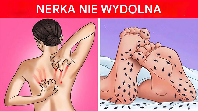 8 dziwnych oznak, że Twoje nerki potrzebują pomocy