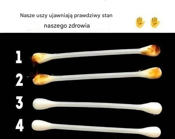 Nasze uszy pokazują prawdziwy stan naszego zdrowia!!