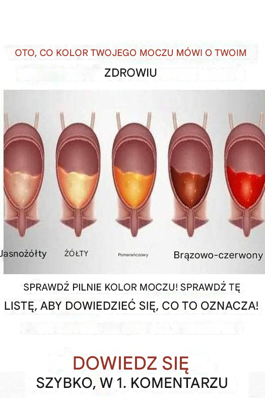 Kolor moczu może ujawnić wszystko na temat Twojego zdrowia! (Sprawdź tę listę pilnie!)