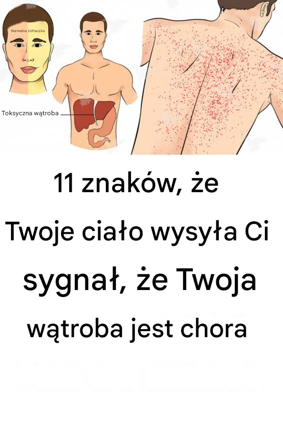 Znaki, że Twoja wątroba jest chora