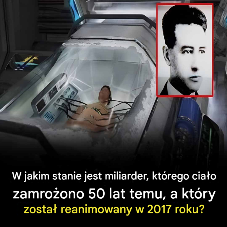 W jakim stanie jest obecnie miliarder, którego ciało zostało kriogenicznie zamrożone 50 lat temu, a który został reanimowany w 2017 roku?