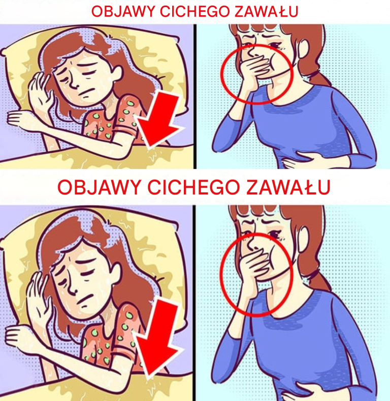 6 wciąż ignorowanych oznak cichego zawału serca… Zobacz więcej