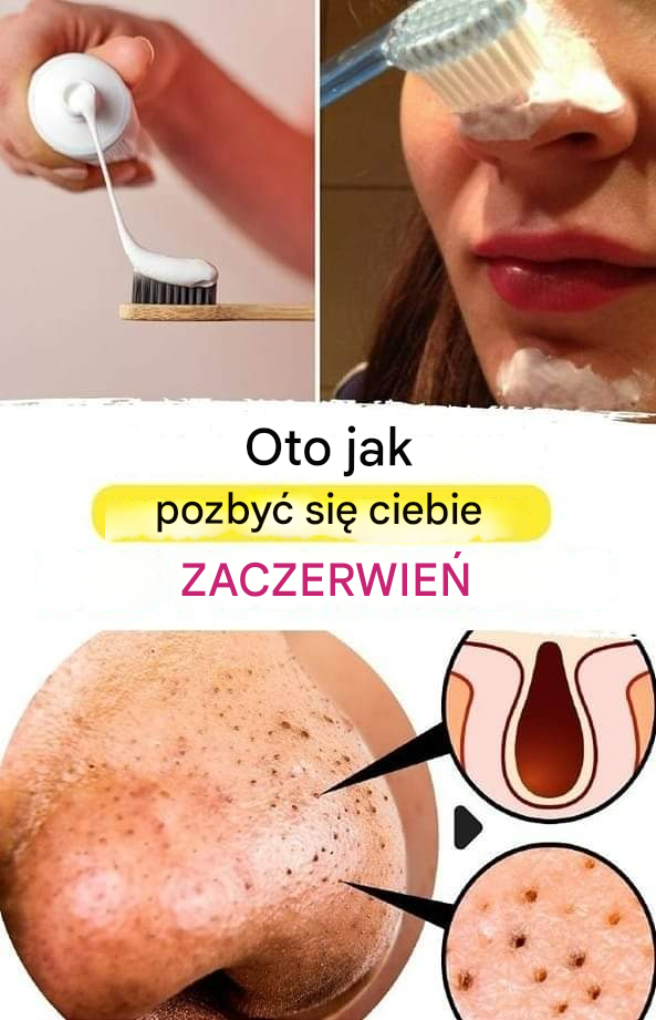 Jak usunąć zaskórniki z twarzy za pomocą szczoteczki do zębów?