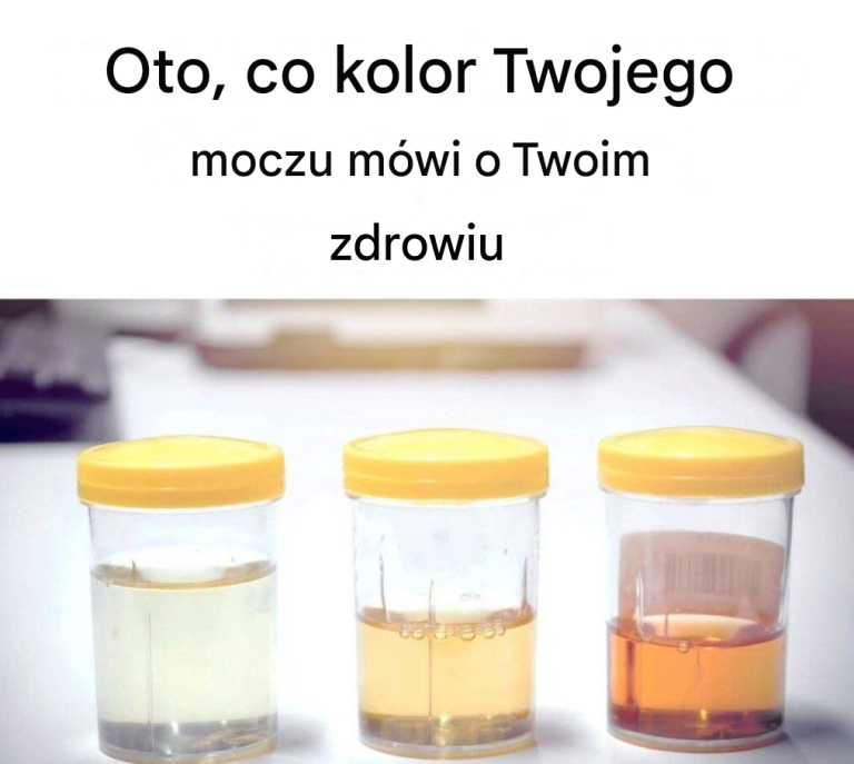 Co kolor moczu mówi o Twoim zdrowiu