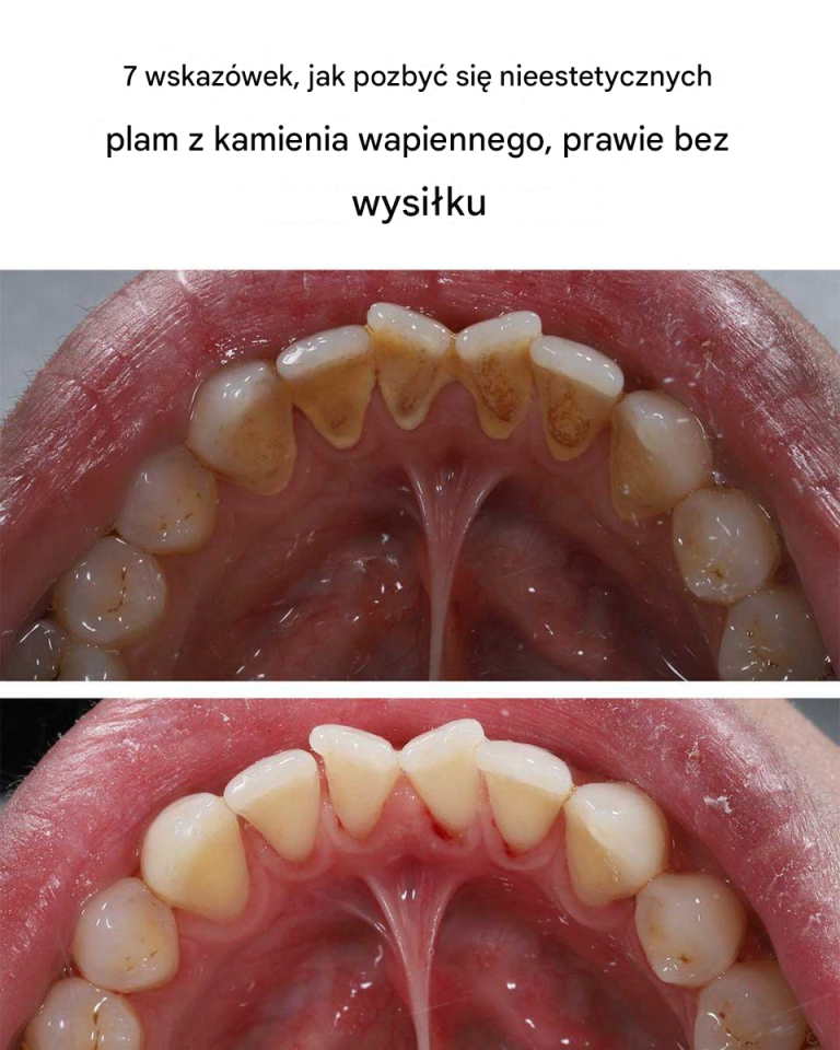 7 wskazówek, jak pozbyć się nieestetycznych plam z kamienia wapiennego, prawie bez wysiłku