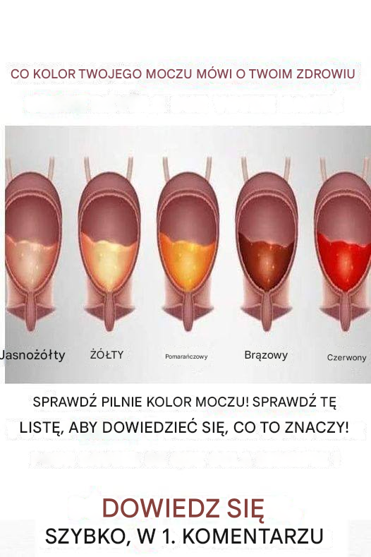 Kolor moczu może ujawnić wszystko na temat Twojego zdrowia! (Pilnie zapoznaj się z tą listą!)