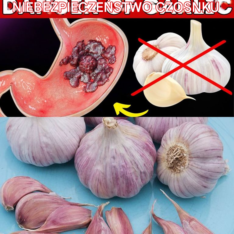 Sięgnij po czosnek, ale unikaj tego częstego błędu! | 95% ludzi nie jest świadomych