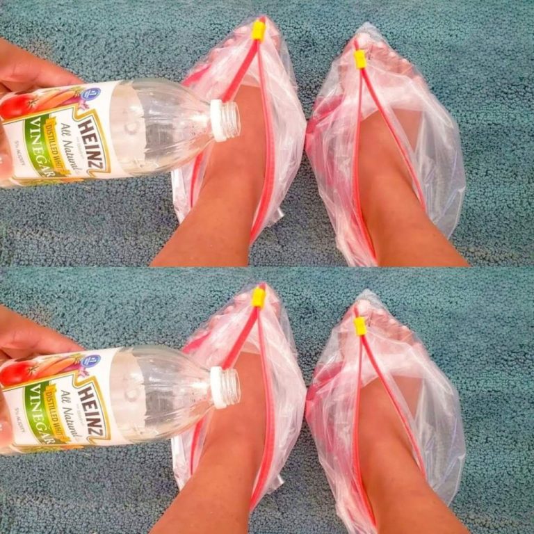 Cudowne właściwości octu dla Twoich stóp