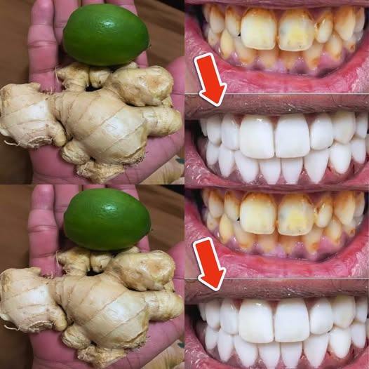 Jak wybielić zęby cytryną i imbirem?