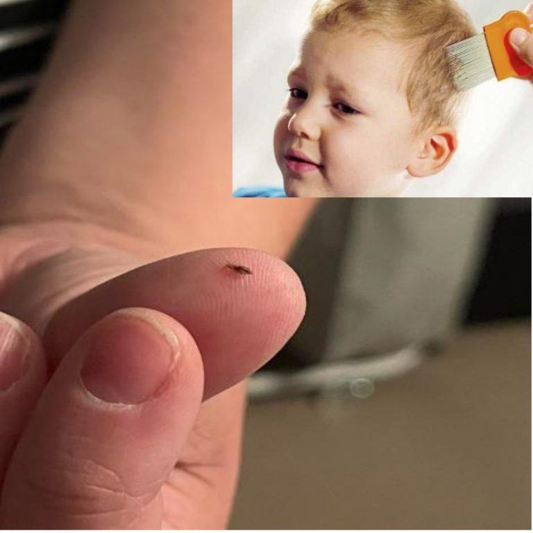 Jak uchronić dzieci (i dorosłych!) przed wszawicą?