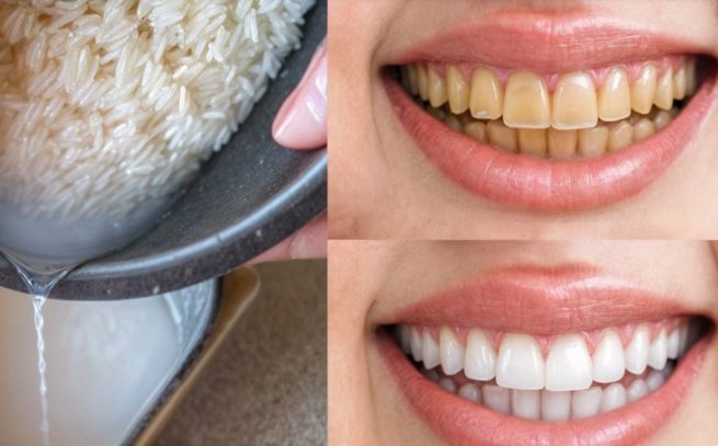 „Promienny uśmiech w 60 sekund! Odkryj ten domowy trik, aby natychmiast wybielić zęby”.