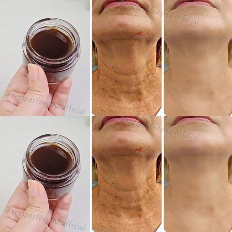 Magiczny olejek przeciwstarzeniowy: olejek kawowy, który usuwa zmarszczki i jest skuteczniejszy niż botoks!