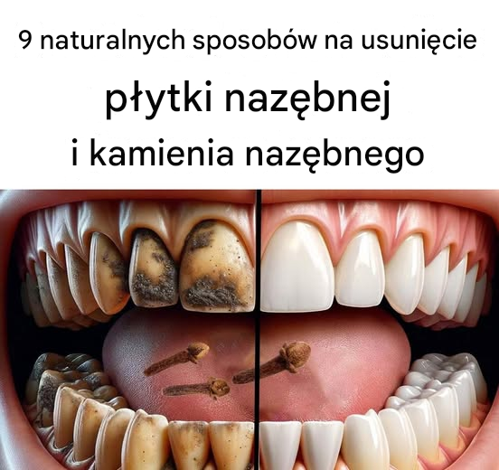 9 naturalnych sposobów na usunięcie płytki nazębnej i kamienia nazębnego