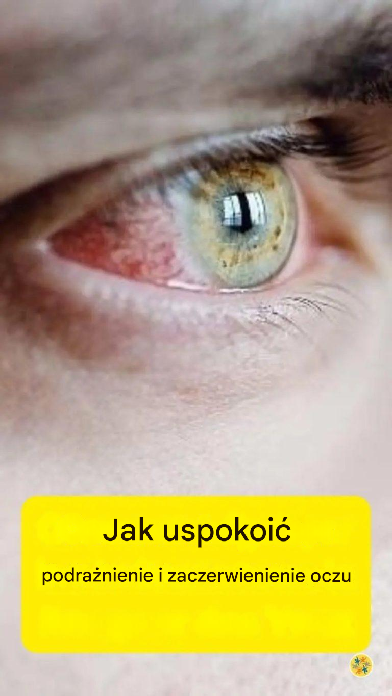 Jedzenie, które w mgnieniu oka uleczy Twoje obolałe oczy!!