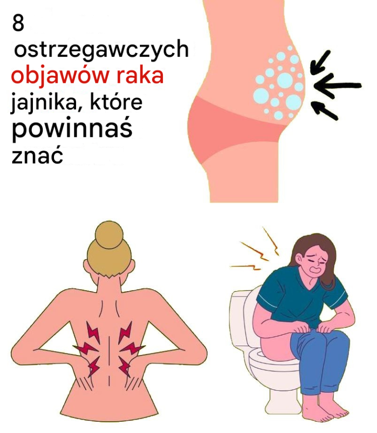 8 ostrzegawczych objawów raka jajnika, których nie należy ignorować