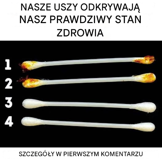 Nasze uszy ujawniają prawdziwy stan naszego zdrowia