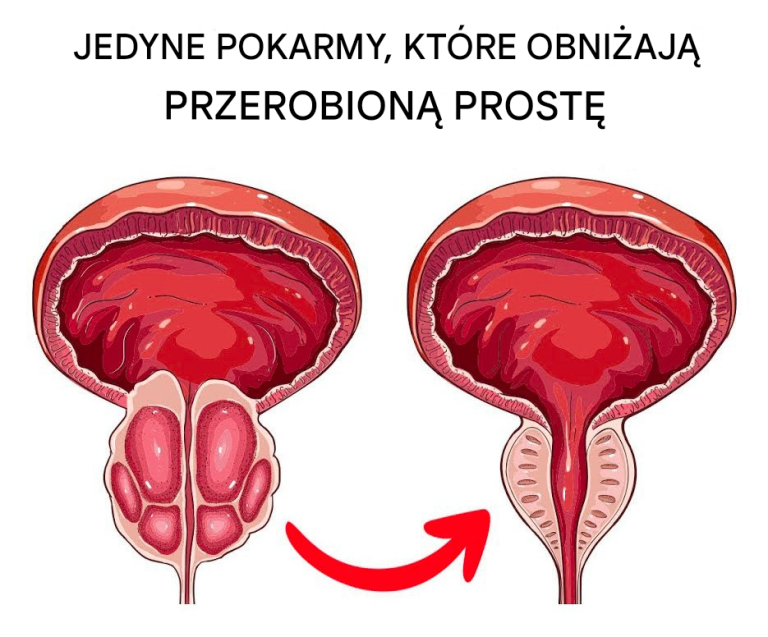 Jedzenie, które zmniejsza powiększoną prostatę