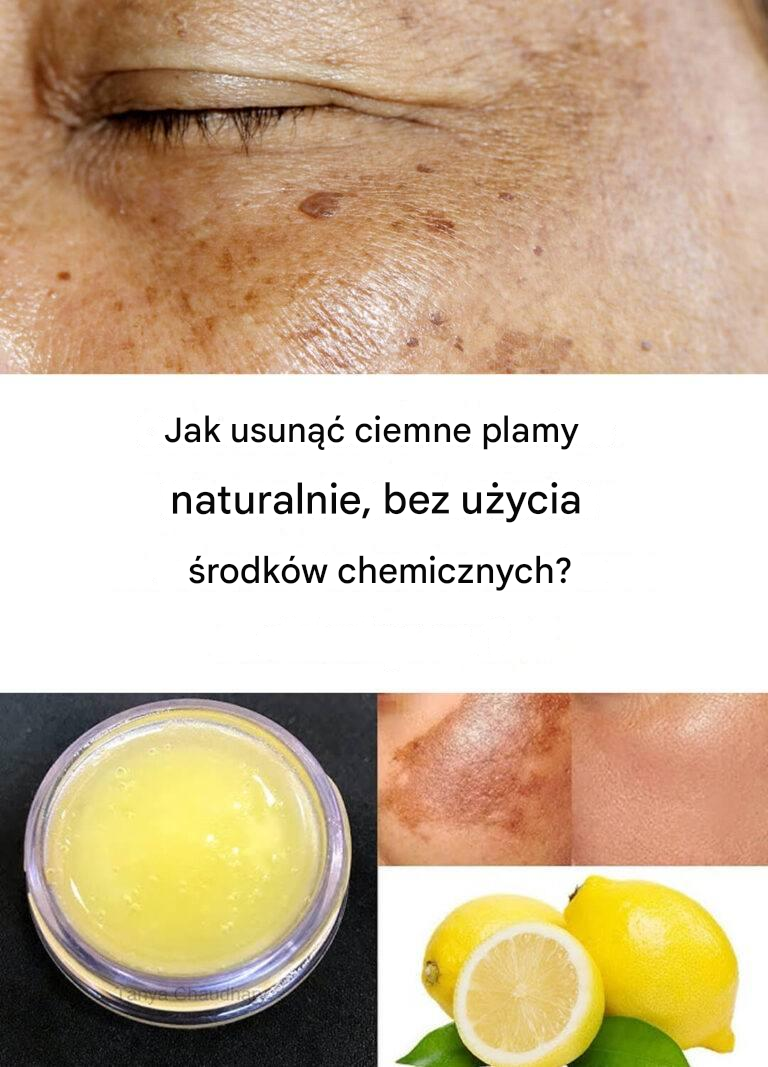 Jak pozbyć się ciemnych plam przy pomocy naturalnych środków?