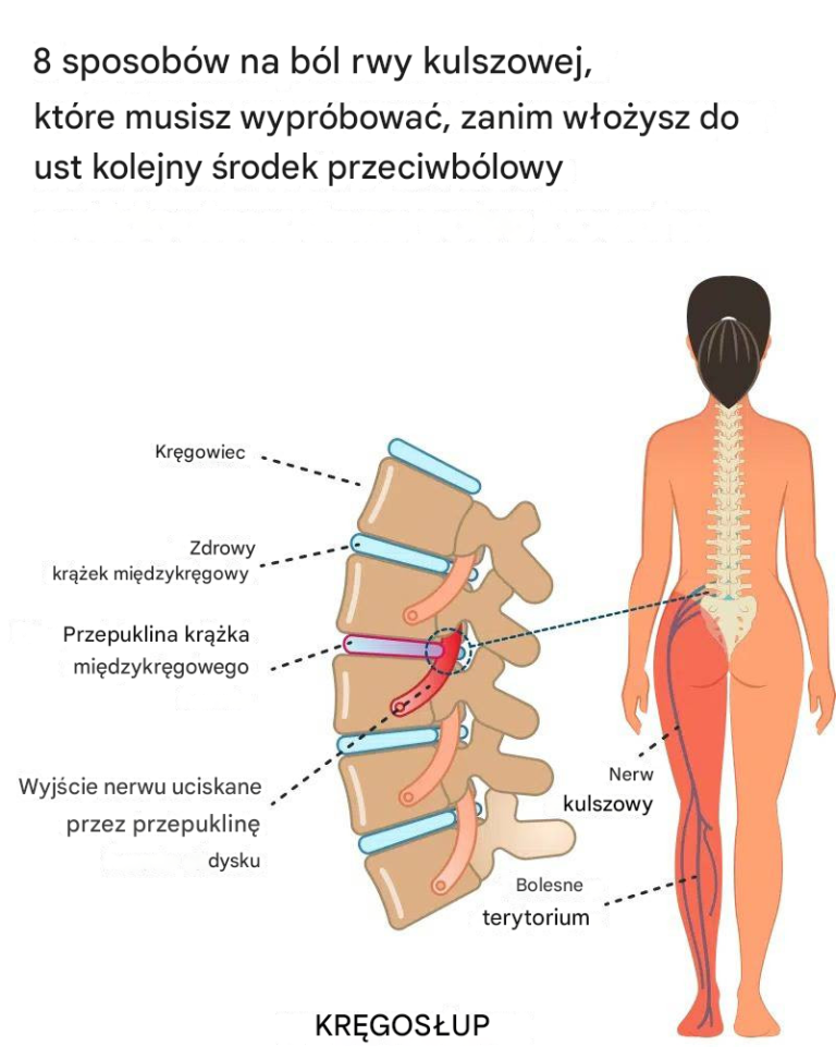 8 sposobów na ból rwy kulszowej, które musisz wypróbować, zanim włożysz do ust kolejny środek przeciwbólowy