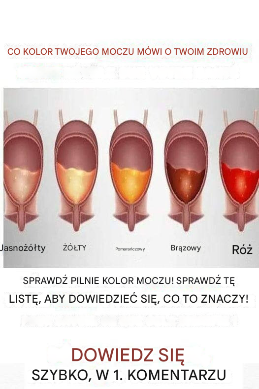 Kolor moczu może ujawnić wszystko na temat Twojego zdrowia! (Pilnie zapoznaj się z tą listą!)