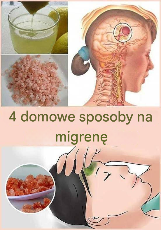 4 domowe sposoby na migrenę!