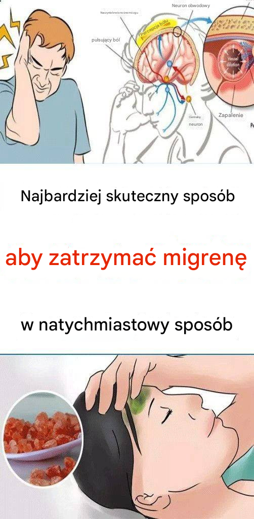 Najbardziej skuteczny sposób na natychmiastowe zatrzymanie migreny