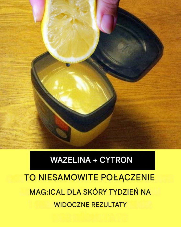 Przepis na wazelinę i cytrynę dla skóry