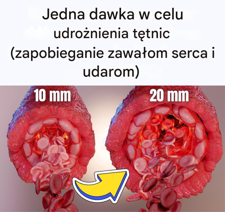 Jedna dawka w celu udrożnienia tętnic (zapobieganie zawałom serca i udarom)