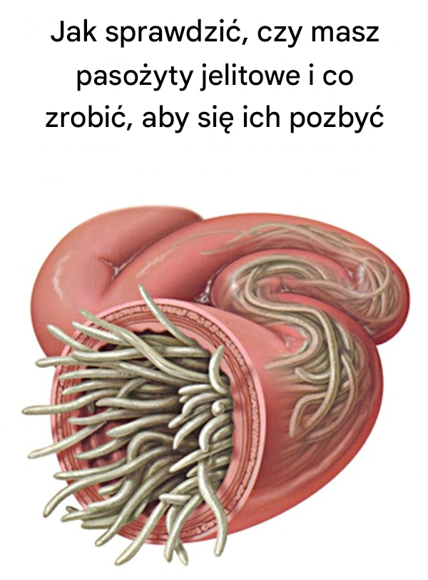Jak sprawdzić, czy masz pasożyty jelitowe i co zrobić, aby się ich pozbyć