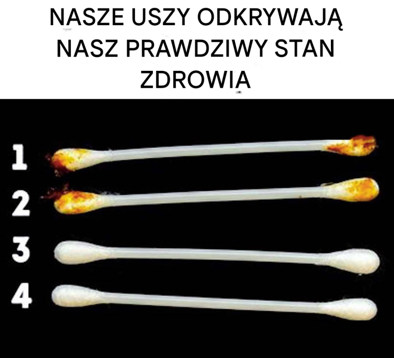 Nasze uszy ujawniają prawdziwy stan naszego zdrowia