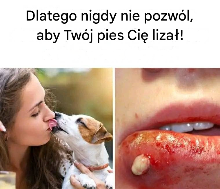 Dlatego nigdy nie pozwól, aby Twój pies Cię lizał!
