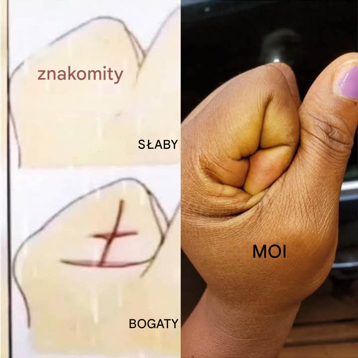 Twoja ręka może ci pokazać, czy będziesz bogaty, czy biedny…