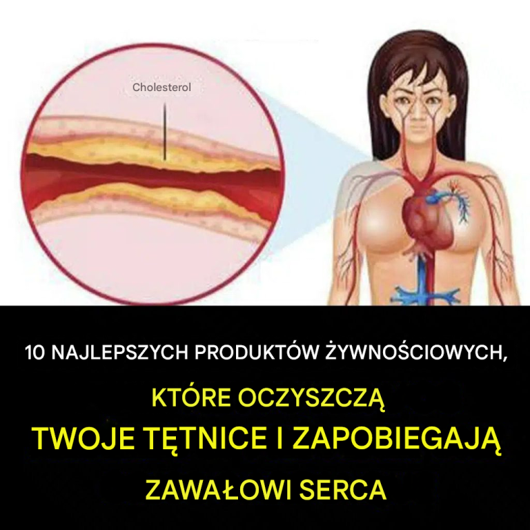 10 produktów spożywczych, które należy jeść codziennie, aby zachować zdrowe tętnice