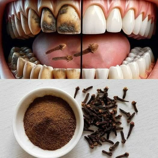 9 naturalnych sekretów na jaśniejszy uśmiech: usuwanie płytki nazębnej i kamienia nazębnego