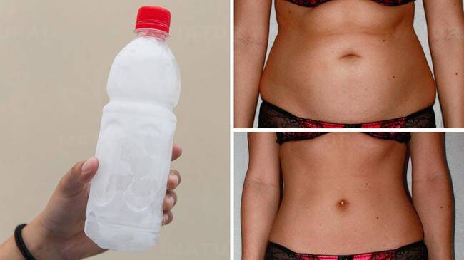 Możesz schudnąć stosując wyłącznie okłady z lodu