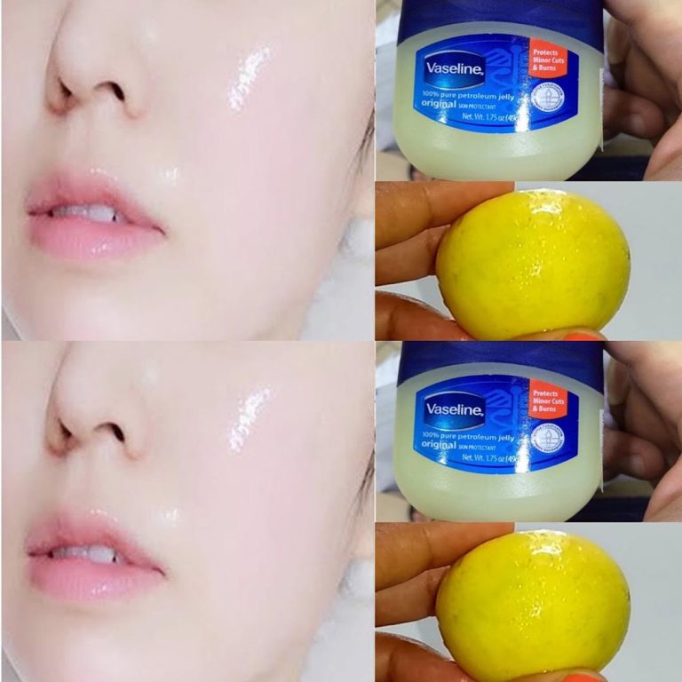 Wazelina i cytryna dla promiennej skóry: jak stosować na skórę