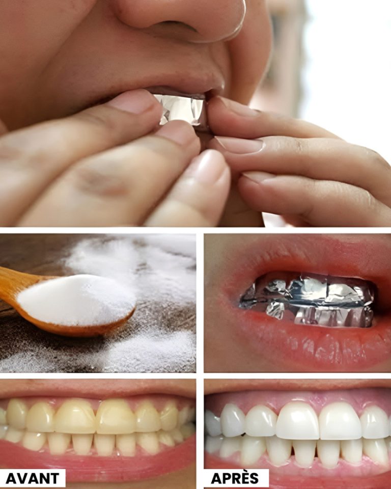 Jak wybielić zęby solą i czosnkiem?