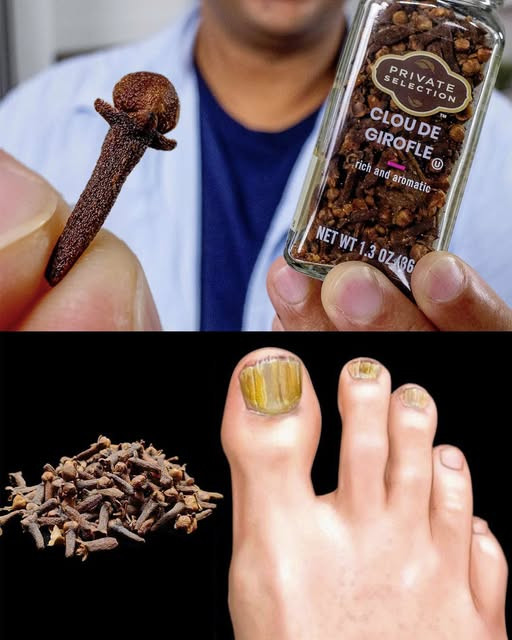 Wyeliminuj grzybicę paznokci w sposób naturalny