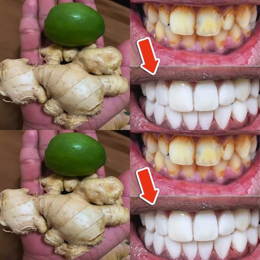 Jak wybielić zęby cytryną i imbirem?