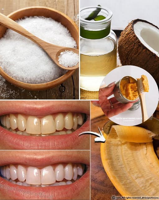 4 naturalne wskazówki, jak uzyskać bielsze zęby w domu