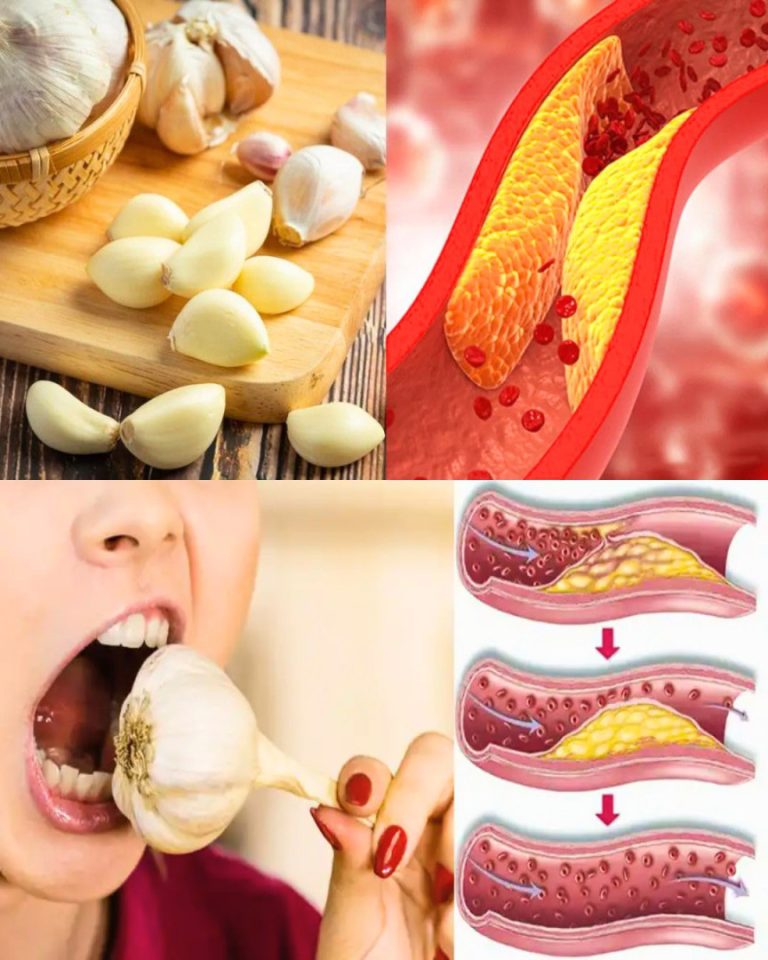 Jedzenie surowego czosnku każdego dnia: naturalny sposób na wsparcie zdrowia serca i obniżenie poziomu cholesterolu