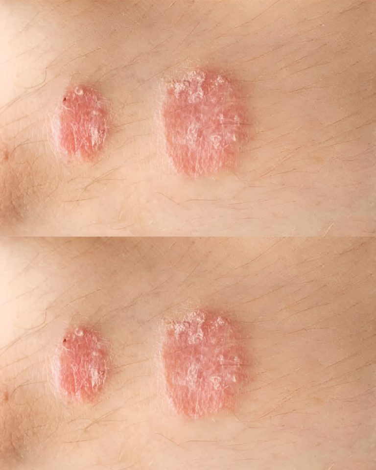 Ostrzegawcze znaki, których nigdy nie należy ignorować w przypadku skóry