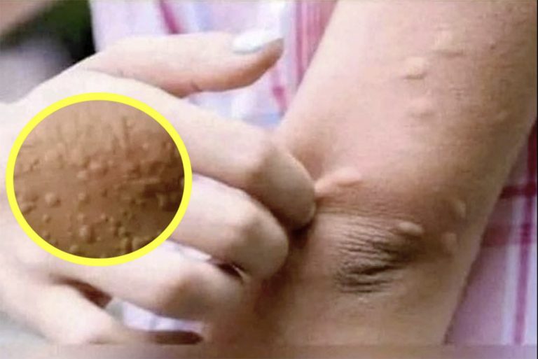 Kiedy zaczynają swędzieć Cię ramiona: to tylko dyskomfort czy prawdziwy sygnał?