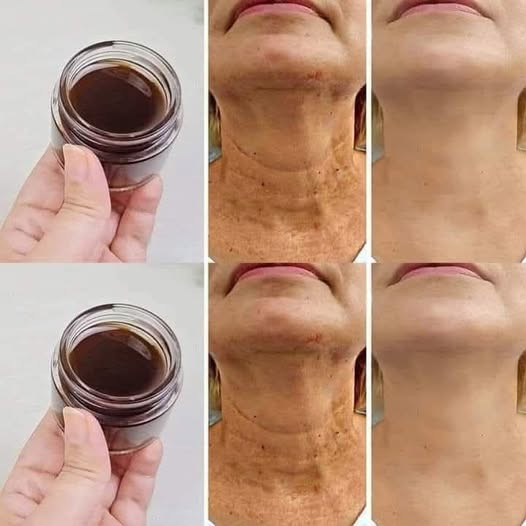 Jak naturalnie usunąć oznaki starzenia?