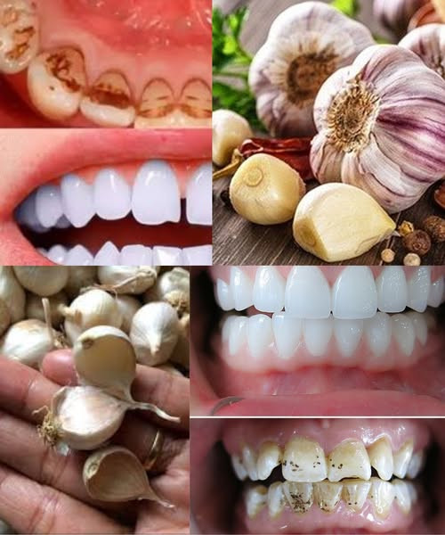 Naturalne sekrety promiennych ust