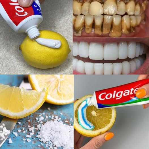 Domowy sposób na bielsze zęby: moc cytryny