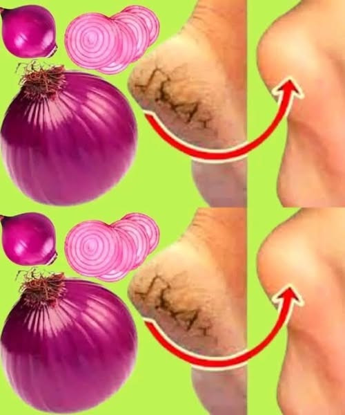 Naturalny sekret leczenia uszkodzonych stóp