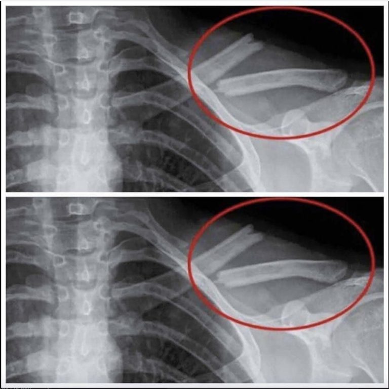 Mało znane skutki zaprzestania picia napojów dietetycznych
