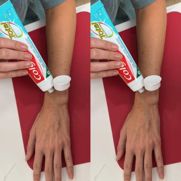 Innowacyjny domowy sposób: rozjaśnij plamy starcze pastą do zębów